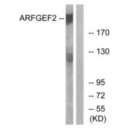 Western blot - ARFGEF2 Antibody from Signalway Antibody (34510) - Antibodies.com