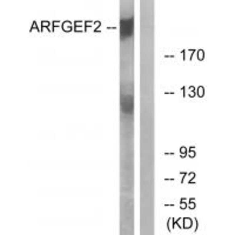 Western blot - ARFGEF2 Antibody from Signalway Antibody (34510) - Antibodies.com