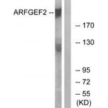 Western blot - ARFGEF2 Antibody from Signalway Antibody (34510) - Antibodies.com