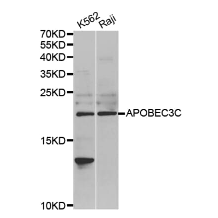 Western blot - APOBEC3C antibody from Signalway Antibody (38703) - Antibodies.com