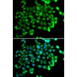 Immunofluorescence - APOBEC3C antibody from Signalway Antibody (38703) - Antibodies.com