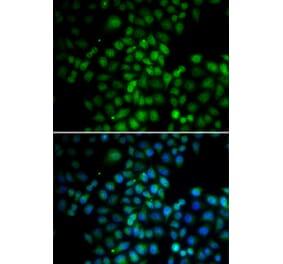 Immunofluorescence - C11orf30 antibody from Signalway Antibody (38728) - Antibodies.com