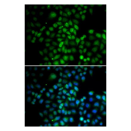 Immunofluorescence - C11orf30 antibody from Signalway Antibody (38728) - Antibodies.com