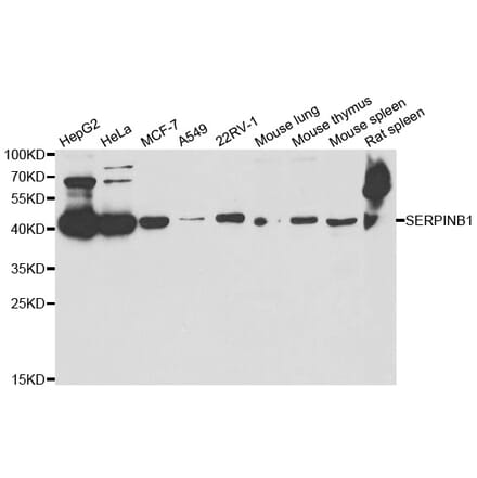 Western blot - SERPINB1 antibody from Signalway Antibody (38783) - Antibodies.com