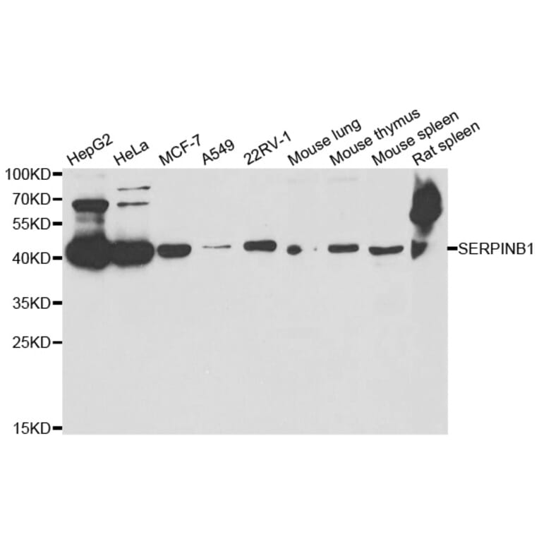 Western blot - SERPINB1 antibody from Signalway Antibody (38783) - Antibodies.com