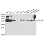 Western blot - SERPINB1 antibody from Signalway Antibody (38783) - Antibodies.com