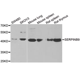Western blot - SERPINB9 antibody from Signalway Antibody (38873) - Antibodies.com