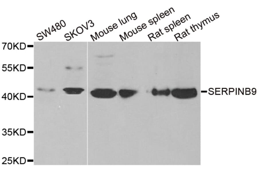 Western blot - SERPINB9 antibody from Signalway Antibody (38873) - Antibodies.com