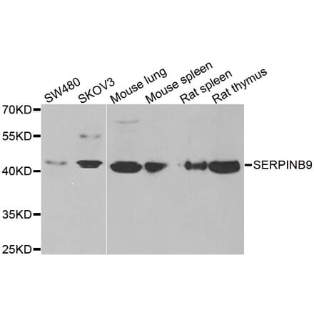 Western blot - SERPINB9 antibody from Signalway Antibody (38873) - Antibodies.com