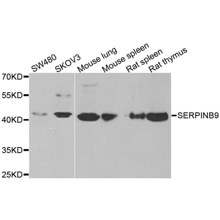 Western blot - SERPINB9 antibody from Signalway Antibody (38873) - Antibodies.com