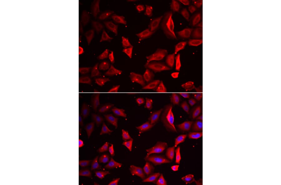 Immunofluorescence - SERPINB9 antibody from Signalway Antibody (38873) - Antibodies.com