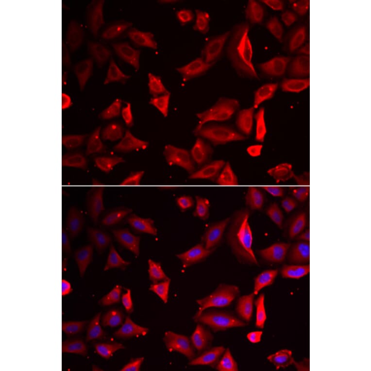 Immunofluorescence - SERPINB9 antibody from Signalway Antibody (38873) - Antibodies.com