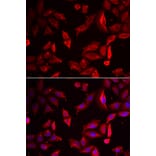 Immunofluorescence - SERPINB9 antibody from Signalway Antibody (38873) - Antibodies.com