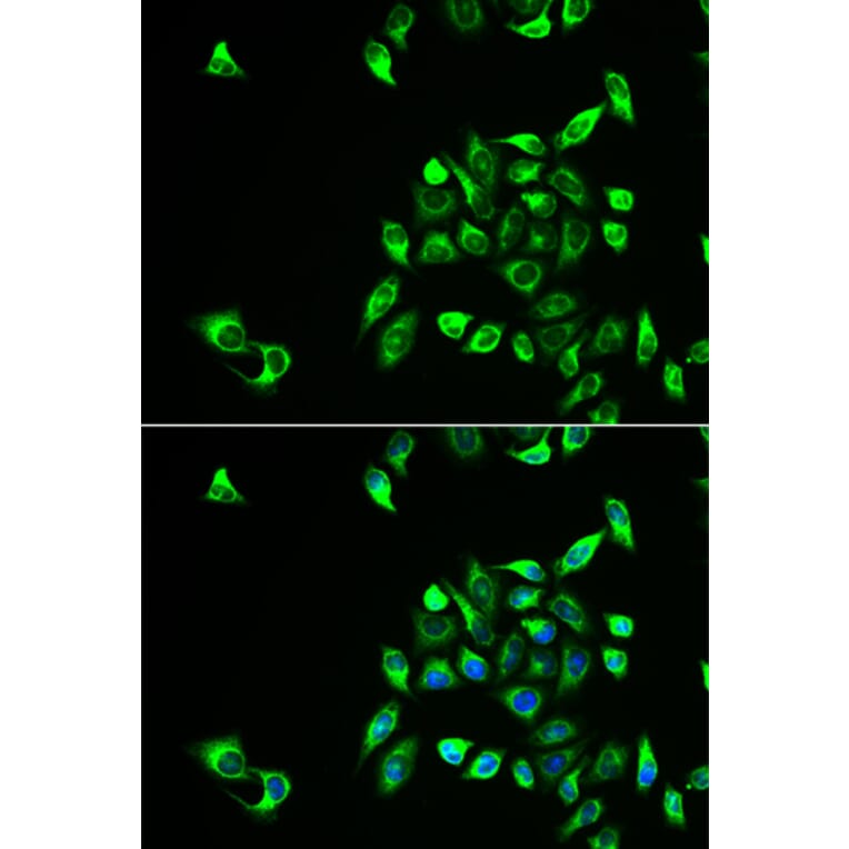 Immunofluorescence - CSNK1A1L antibody from Signalway Antibody (38962) - Antibodies.com