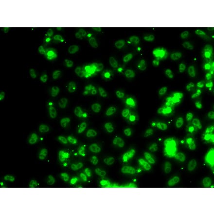 Immunofluorescence - SECISBP2 antibody from Signalway Antibody (39141) - Antibodies.com