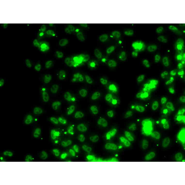 Immunofluorescence - SECISBP2 antibody from Signalway Antibody (39141) - Antibodies.com