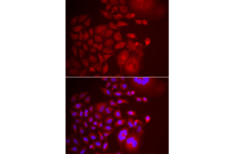 Immunofluorescence - TRAPPC10 antibody from Signalway Antibody (39173) - Antibodies.com