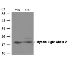 Western blot - Myosin Light Chain 2 (Ab-19) Antibody from Signalway Antibody (21157) - Antibodies.com