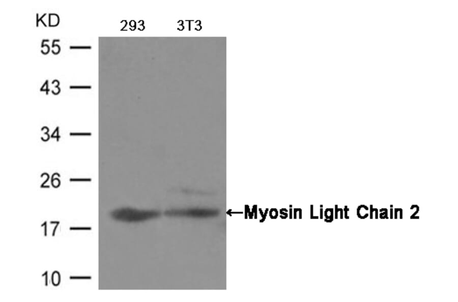 Western blot - Myosin Light Chain 2 (Ab-19) Antibody from Signalway Antibody (21157) - Antibodies.com