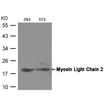 Western blot - Myosin Light Chain 2 (Ab-19) Antibody from Signalway Antibody (21157) - Antibodies.com