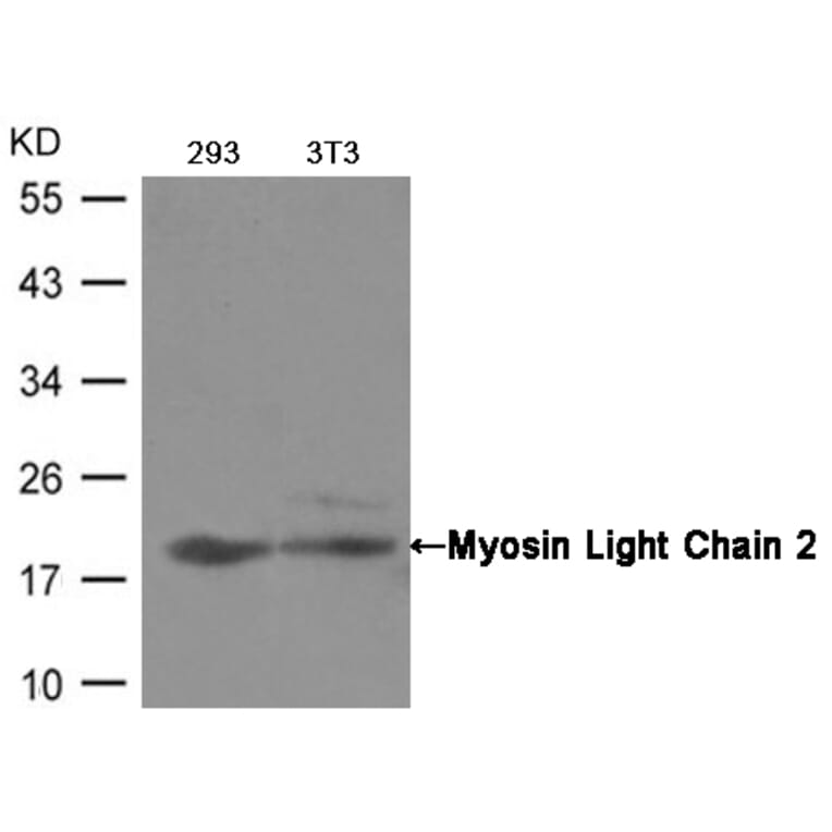 Western blot - Myosin Light Chain 2 (Ab-19) Antibody from Signalway Antibody (21157) - Antibodies.com