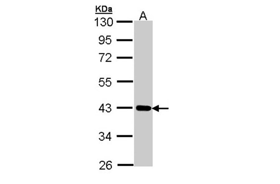 Cartilage-associated protein antibody from Signalway Antibody (22008) - Antibodies.com