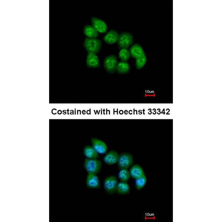 Immunofluorescence - muscleblind-like 3 isoform G antibody from Signalway Antibody (22178) - Antibodies.com