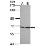 SH3 domain-binding protein 1 antibody from Signalway Antibody (22468) - Antibodies.com