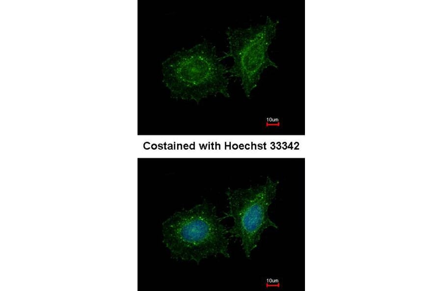 Immunofluorescence - SH3 domain-binding protein 1 antibody from Signalway Antibody (22468) - Antibodies.com