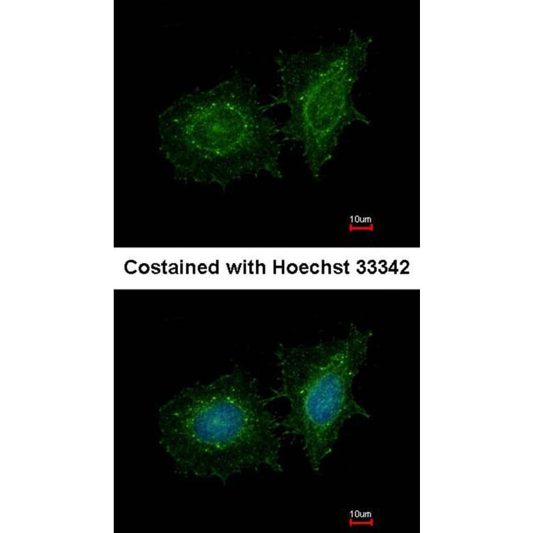 Immunofluorescence - SH3 domain-binding protein 1 antibody from Signalway Antibody (22468) - Antibodies.com