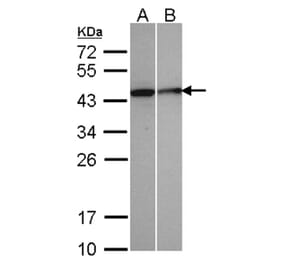 Selenophosphate synthetase 1 antibody from Signalway Antibody (22549) - Antibodies.com