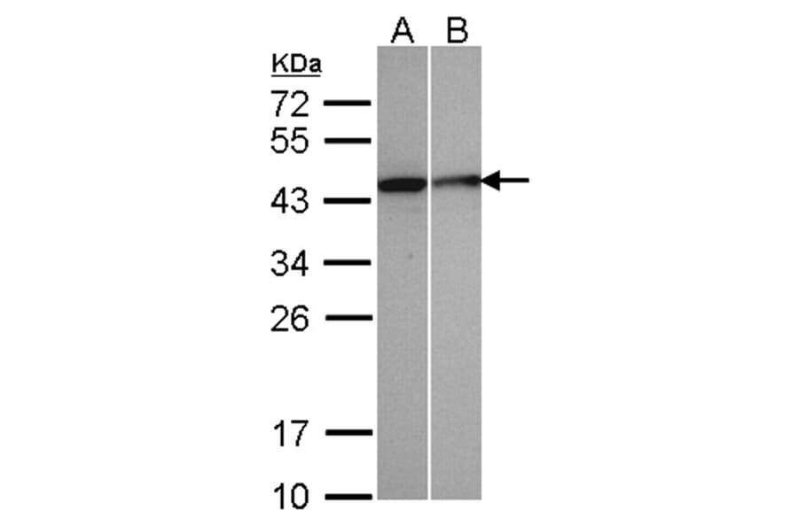Selenophosphate synthetase 1 antibody from Signalway Antibody (22549) - Antibodies.com