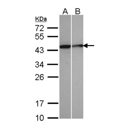Selenophosphate synthetase 1 antibody from Signalway Antibody (22549) - Antibodies.com