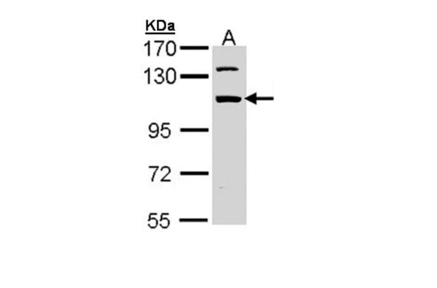 RNA binding motif protein 28 antibody from Signalway Antibody (23138) - Antibodies.com