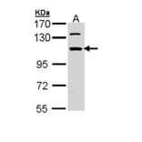 RNA binding motif protein 28 antibody from Signalway Antibody (23138) - Antibodies.com