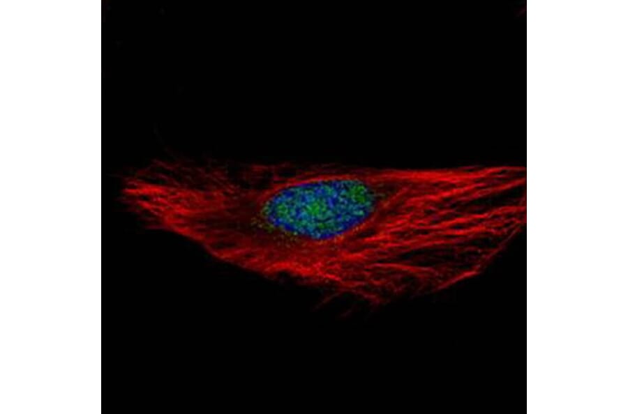 RNA binding motif protein 28 antibody from Signalway Antibody (23138) - Antibodies.com