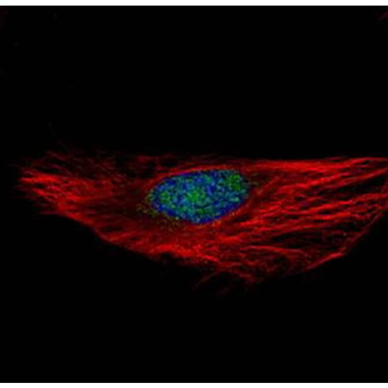 RNA binding motif protein 28 antibody from Signalway Antibody (23138) - Antibodies.com
