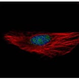 RNA binding motif protein 28 antibody from Signalway Antibody (23138) - Antibodies.com