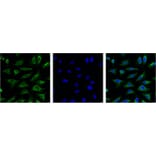 Aquaporin 4 Mouse Monoclonal Antibody from Signalway Antibody (38017) - Antibodies.com