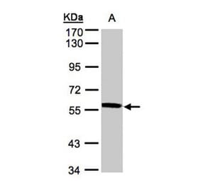 XPNPEP3 antibody from Signalway Antibody (22002) - Antibodies.com