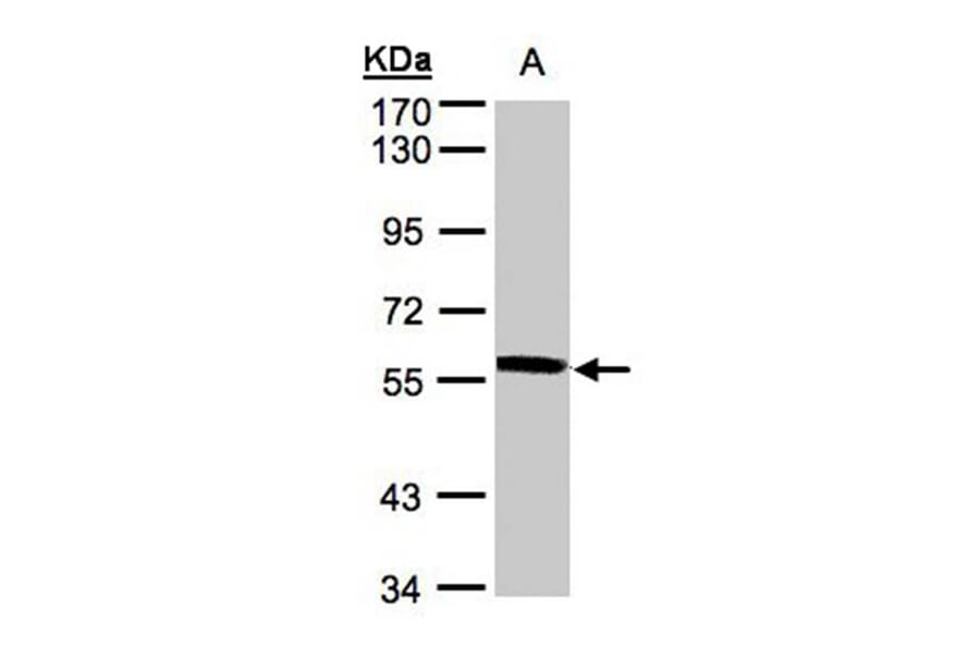 XPNPEP3 antibody from Signalway Antibody (22002) - Antibodies.com
