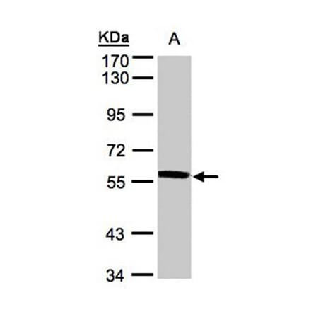 XPNPEP3 antibody from Signalway Antibody (22002) - Antibodies.com