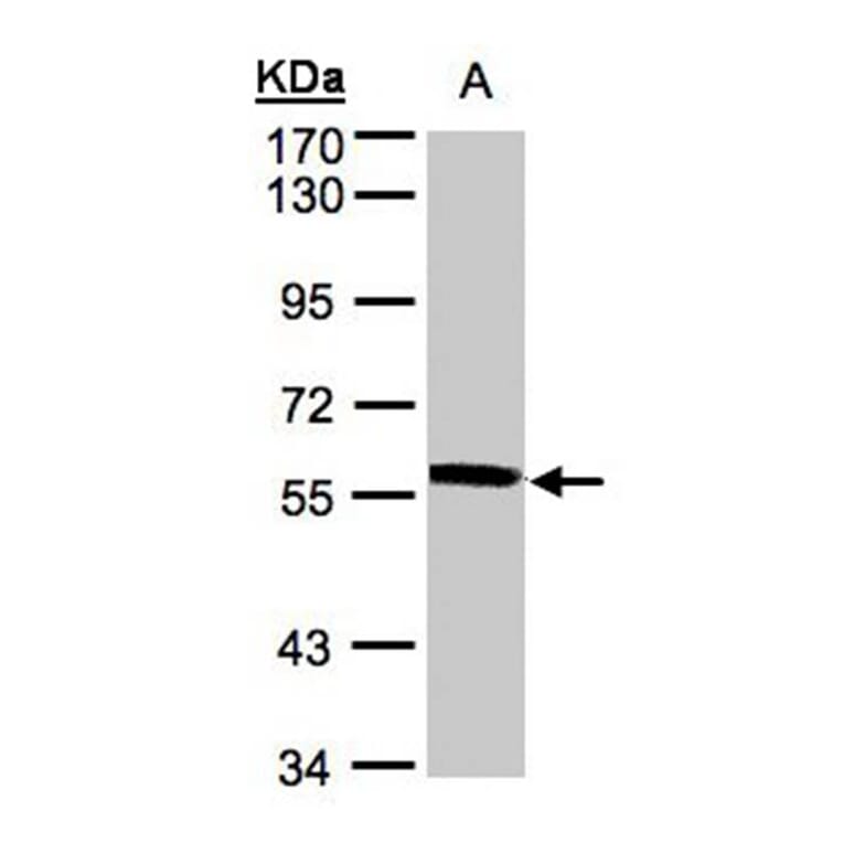XPNPEP3 antibody from Signalway Antibody (22002) - Antibodies.com