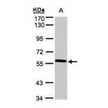 XPNPEP3 antibody from Signalway Antibody (22002) - Antibodies.com
