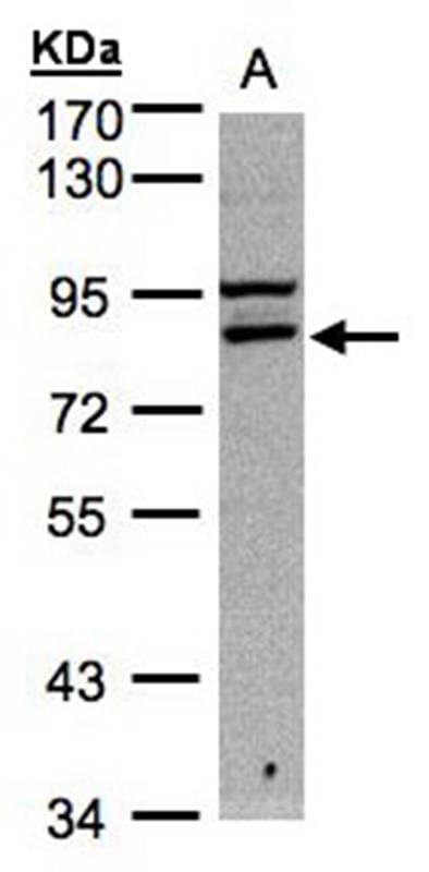 Sample 30ug of Hep G2 whole cell lysate 7.5% SDS PAGE Primary antibody diluted at 1: 1000