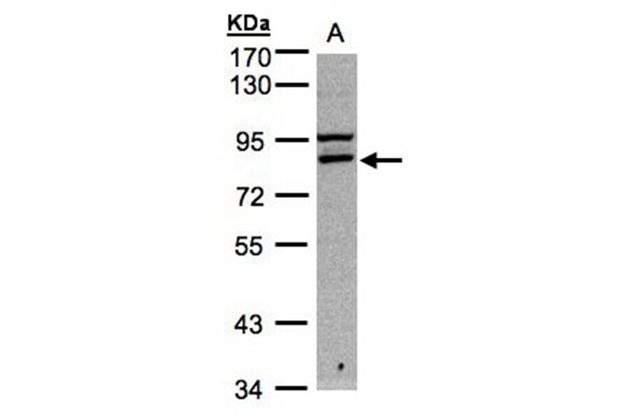 FASTKD1 antibody from Signalway Antibody (22013) - Antibodies.com