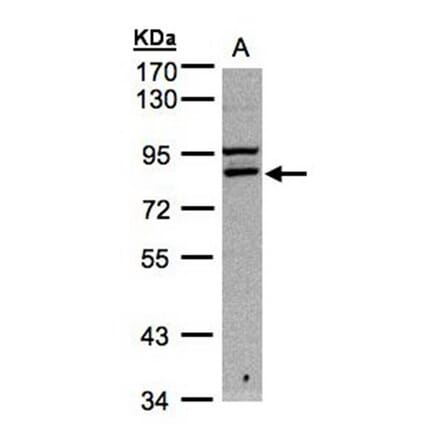 FASTKD1 antibody from Signalway Antibody (22013) - Antibodies.com