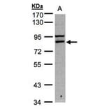FASTKD1 antibody from Signalway Antibody (22013) - Antibodies.com