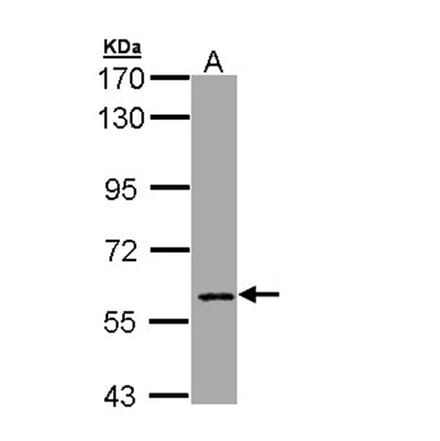 CBFA2T2 antibody from Signalway Antibody (22165) - Antibodies.com