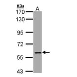 CBFA2T2 antibody from Signalway Antibody (22165) - Antibodies.com